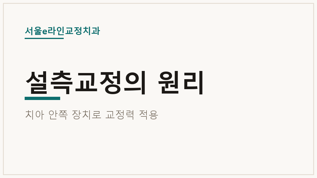 설측교정의 원리