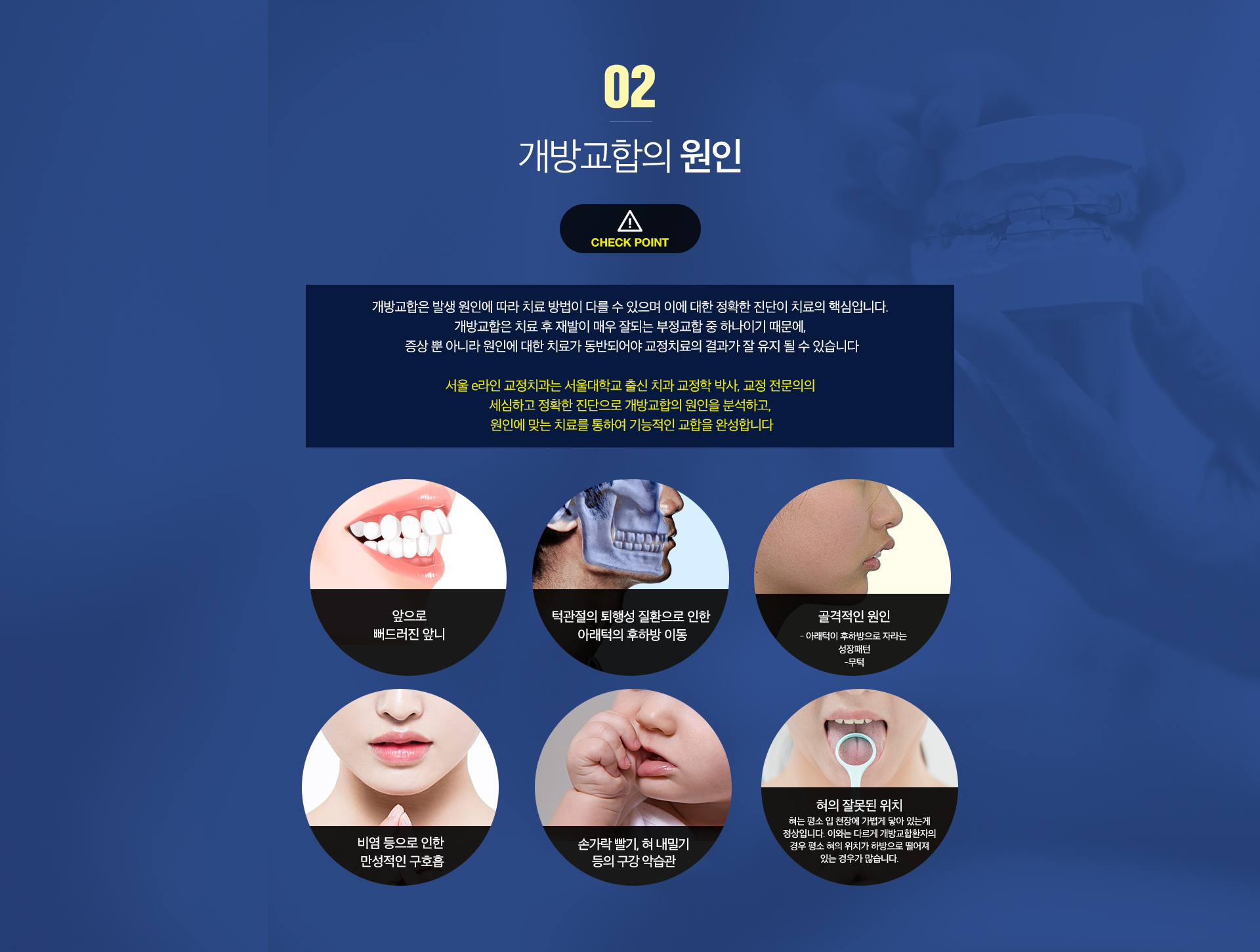 개방교합 원인 사진