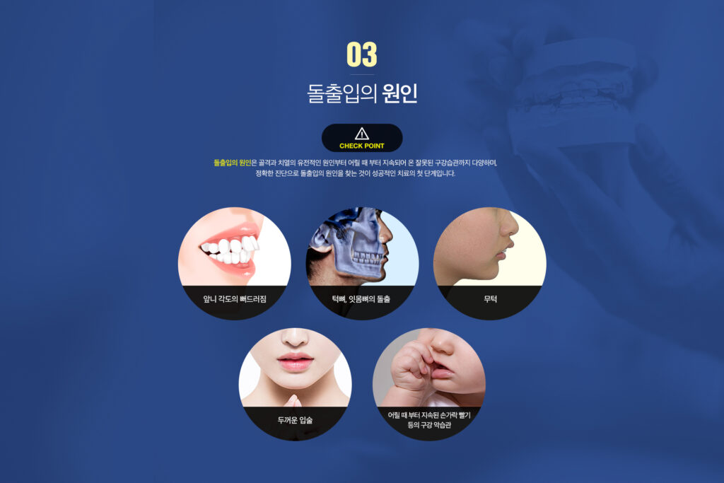 돌출입을 방치하면 나타나는 신호들 — 평택교정치과 설명