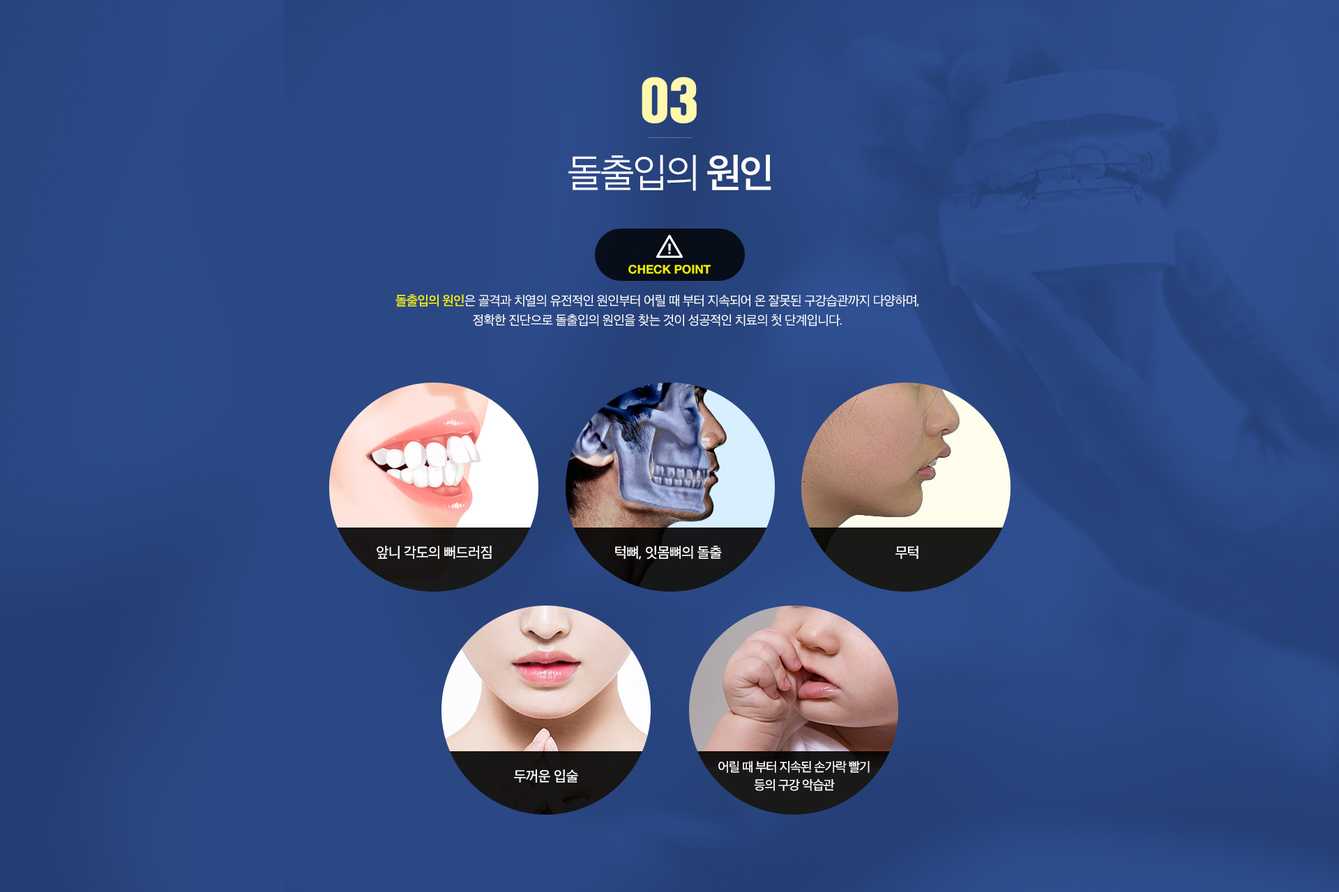 돌출입 원인 사진