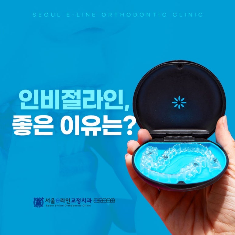 케이스 클로즈업