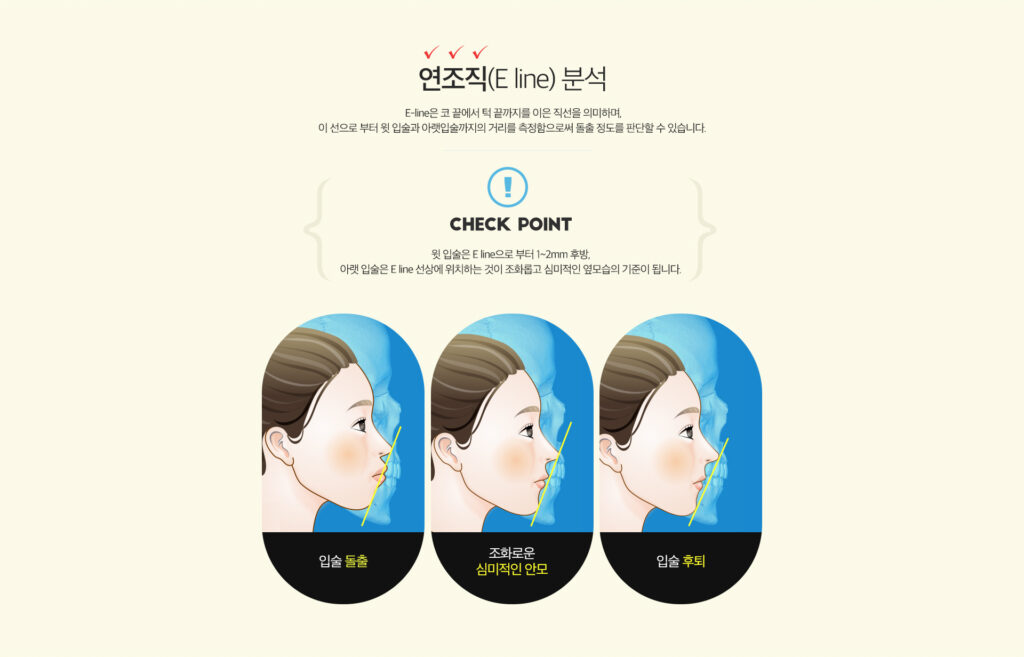 평택교정치과를 고를 때, 비용 말고 함께 봐야 하는 기준 — 서울e라인교정치과