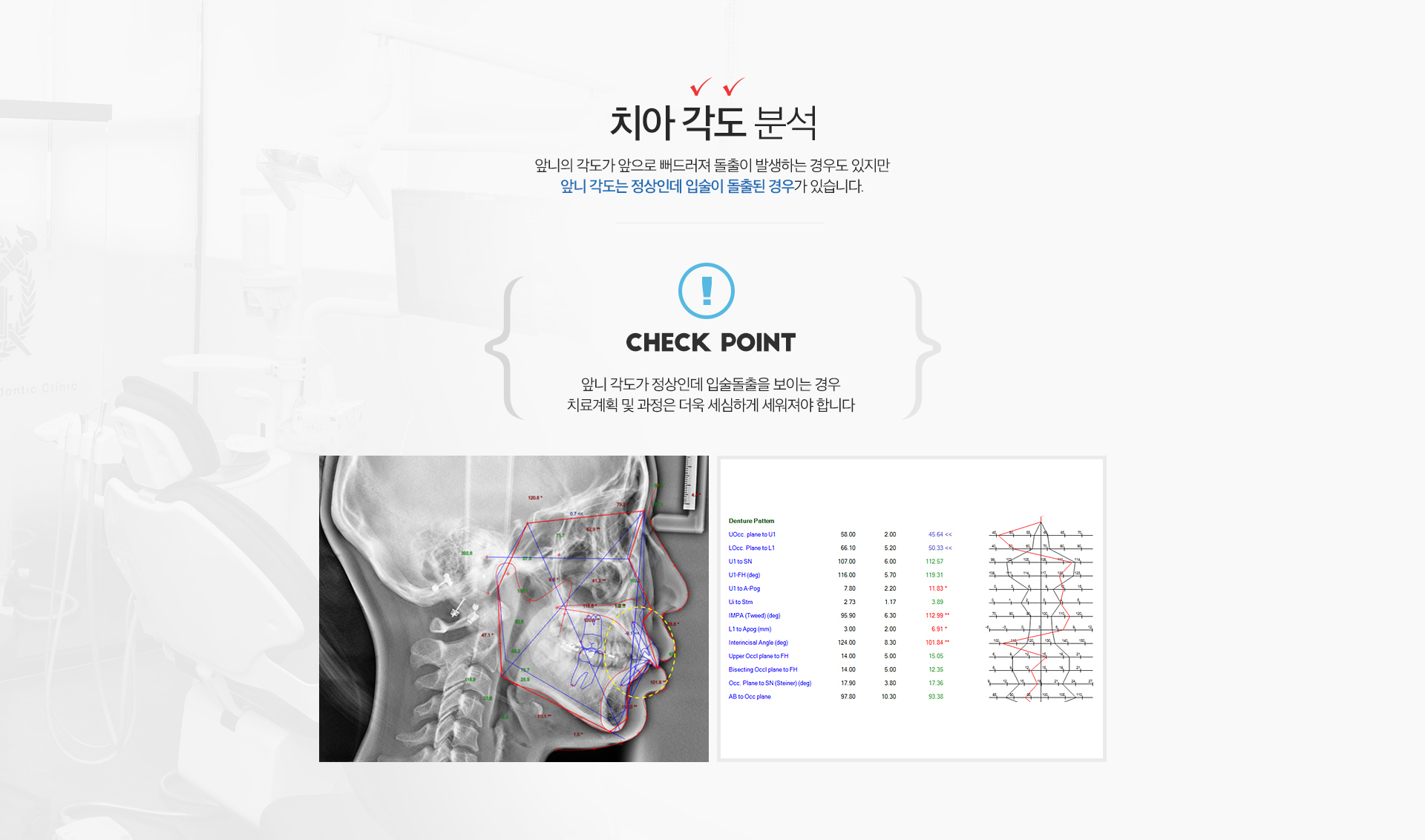 치아 각도 방사선