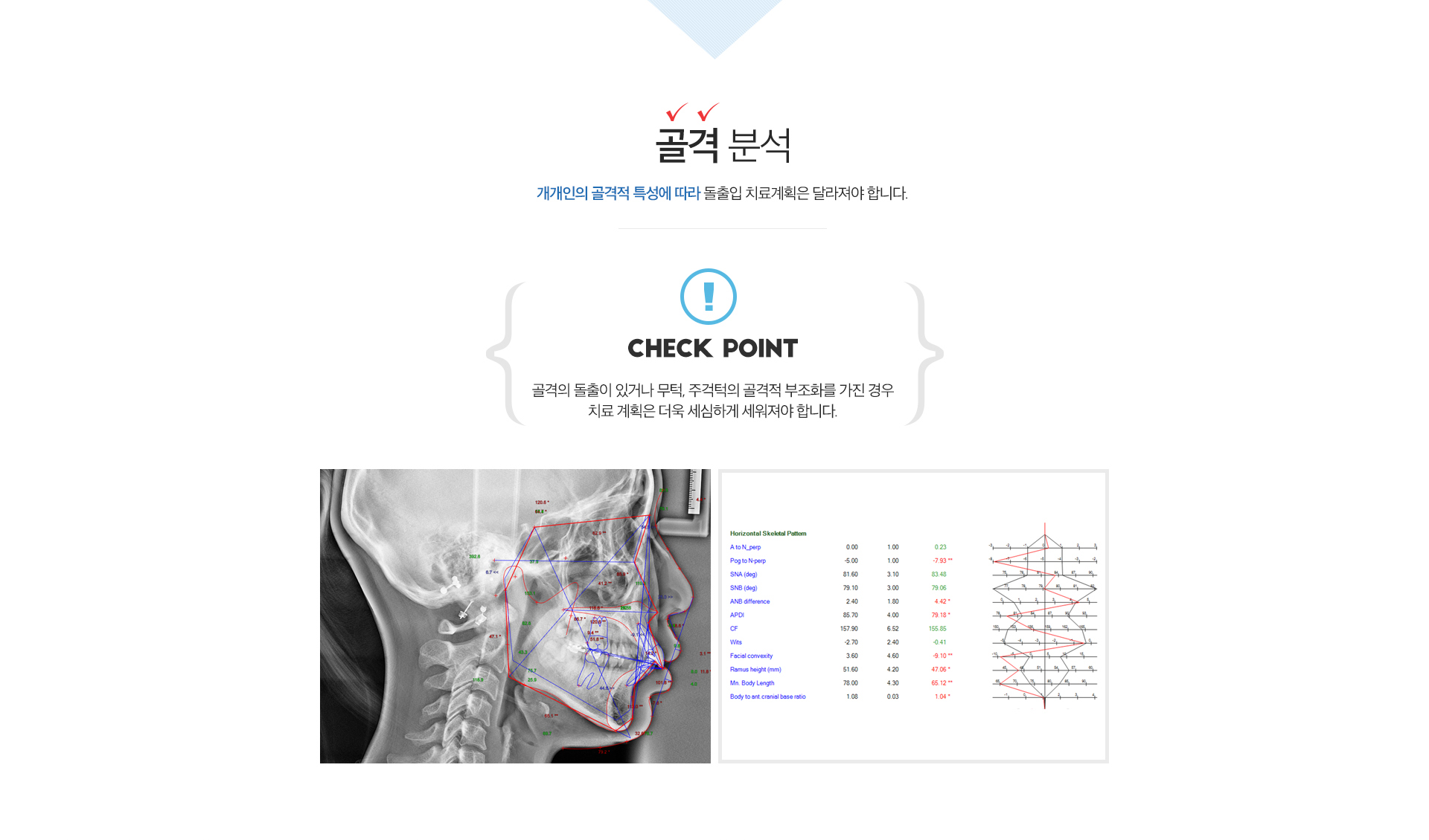 두부 방사선 사진