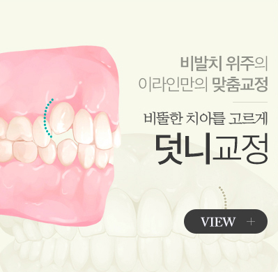 덧니교정 배너