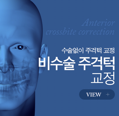 주걱턱교정 배너