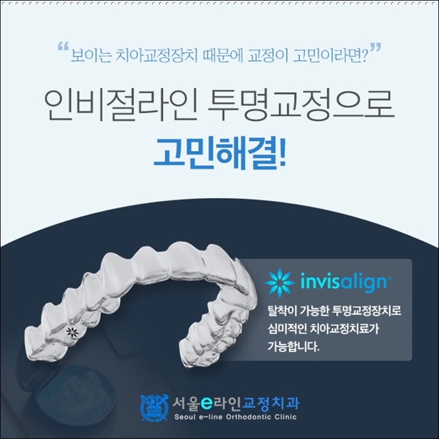 평택 치아교정 장치 유형별 차이, 표로 정리