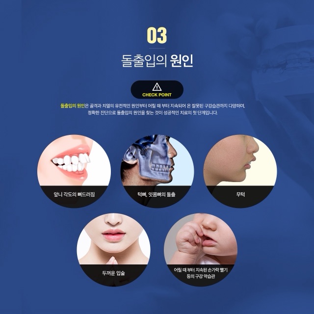 평택덧니, 왜 생기고 교정으로 어떻게 다루나
